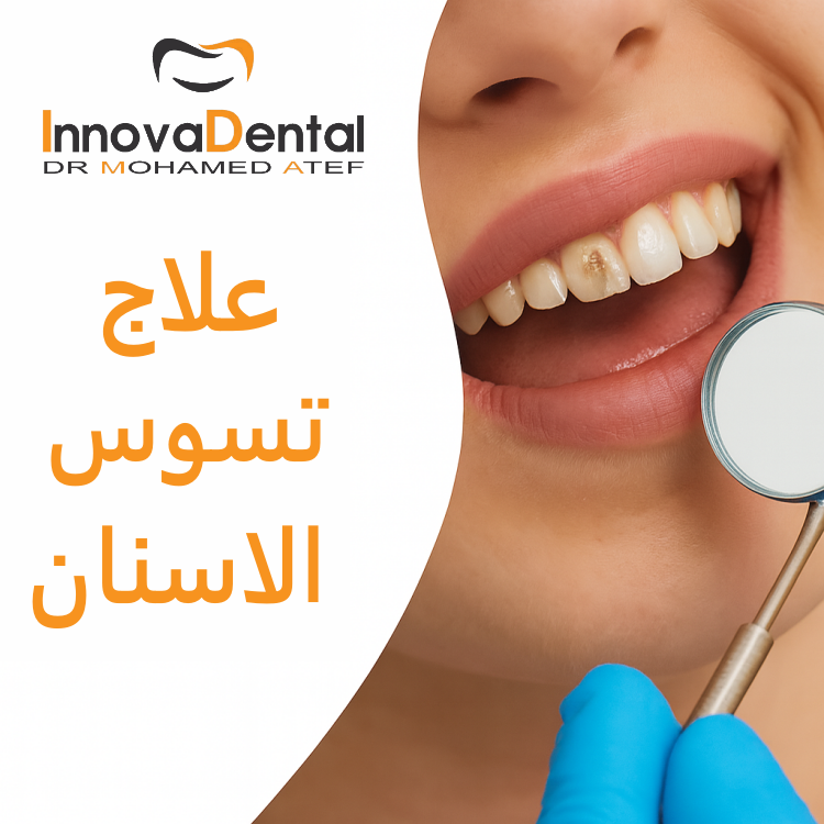 Treatment of tooth decay